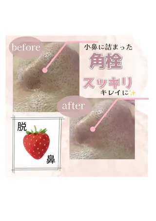 毛穴/いちご鼻/小顔 /hitohanaのエステ・リラクイメージ