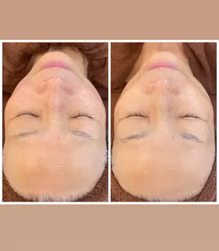 パーソナルスキンケア 🦋APRI🅿️有のエステ・リラクイメージ