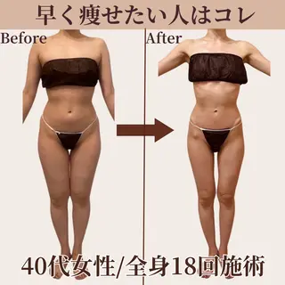 Belle White所属・本格痩身＊透明美肌 BelleWhiteのエステ・リラクイメージ