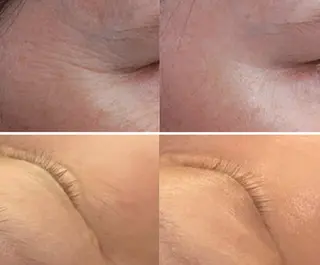 全身脱毛＆VIO脱毛 紹介率№1♪リナ♪のエステ・リラクイメージ