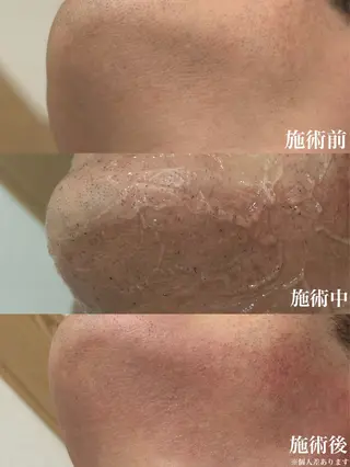 メンズ muumo所属・muumo まりののエステ・リラクイメージ