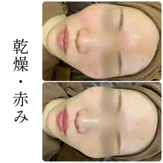 ハーブピーリング専門 BIOEL横浜のエステ・リラクイメージ