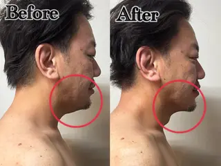 六本木脱毛andS 店長Sachiのエステ・リラクイメージ