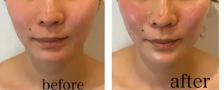 ビューティーサロン B.glossyのネイルデザイン