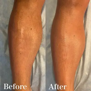 メンズ wax脱毛専門店 ハイラントのエステ・リラクイメージ