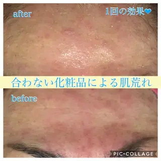 ロング カラー パーマ ヘアアレンジ キッズ ネイル マツエク・マツパ EnsorClair 代表 野口真央のエステ・リラクイメージ