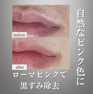 Lumiere despoirのエステ・リラクイメージ