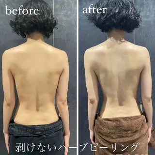 ネイル マツエク・マツパ アイブロウ ニキビ・毛穴改善 🌿ハーブピーリングのエステ・リラクイメージ