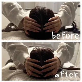 医療提携サロン新宿 La Lunaのエステ・リラクイメージ