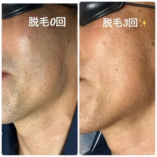 blue.💙【 脱毛&フェイシャル】のエステ・リラクイメージ