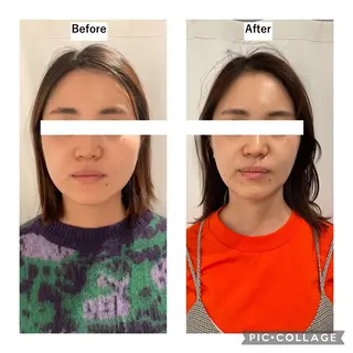 12Dハイフ💗 最強小顔のエステ・リラクイメージ