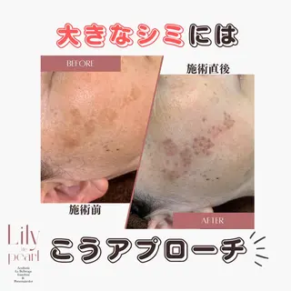 最新シミケアLily de pearlのエステ・リラクイメージ