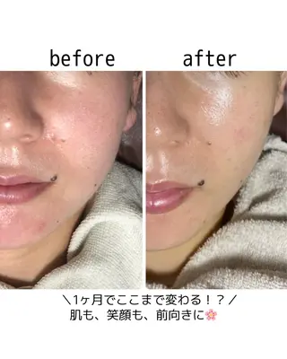 小顔・毛穴・たるみ ネイル　似内真樹のエステ・リラクイメージ