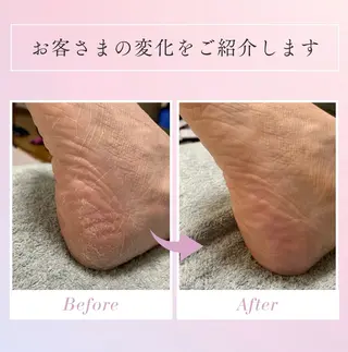 メンズ 足トラブル専門 ニコルル金沢のエステ・リラクイメージ