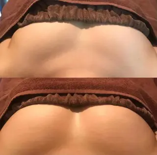 脱毛🌹エステ イルシオン　YUIのエステ・リラクイメージ