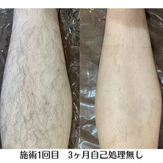 DUPE&MORE 店長kanaeのエステ・リラクイメージ