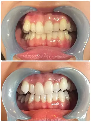 Monreve所属・美人スイッチdiet スーパージェクションのその他イメージ