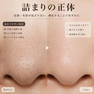 【小顔・毛穴ケア】 セラピスト　和田紋子のエステ・リラクイメージ