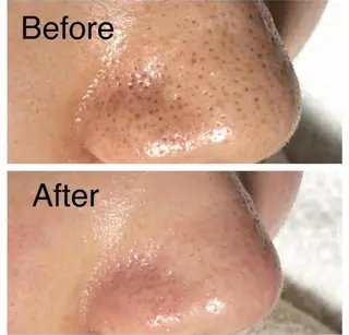 メンズ脱毛サロン X(エックス)のエステ・リラクイメージ