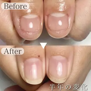 ネイル 深爪専門店 サロンリリーのネイルデザイン