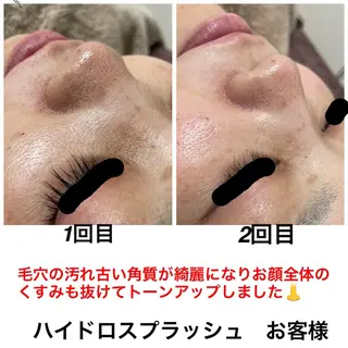 ネイル・エステサロン UILANIのネイルデザイン