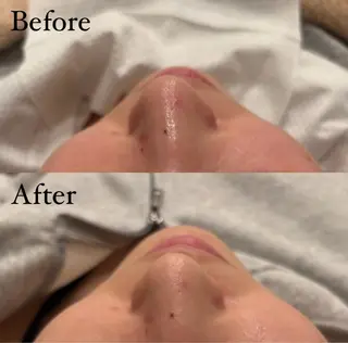 seika🍒 ハリラウンジ梅田のエステ・リラクイメージ