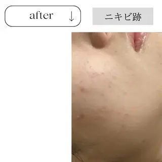 beauty CHOOSEのエステ・リラクイメージ