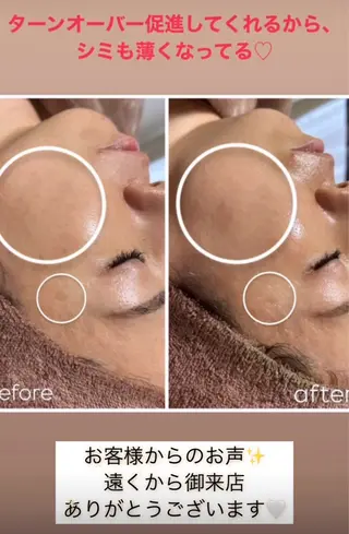 WHITE AQUA 🌼柏店のエステ・リラクイメージ