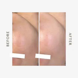 1st｜フェイシャル エステ専門店のエステ・リラクイメージ