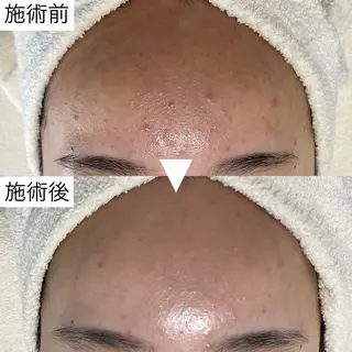 ニキビ・毛穴・ フェイシャル専門店のエステ・リラクイメージ