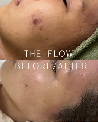 稲垣 優のエステ・リラクイメージ