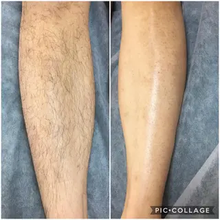 メンズ Laki wax chikaのエステ・リラクイメージ