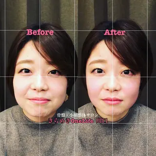 きらめきワンライフ Yumaのエステ・リラクイメージ