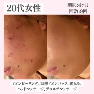 ニキビ・肌質改善専門 ♡人生が変わるサロンのエステ・リラクイメージ