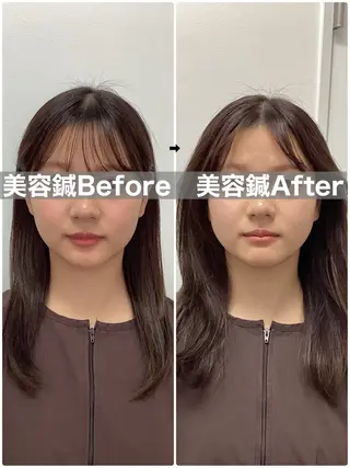 ハリサロンドオフ 美容鍼灸×小顔整体のエステ・リラクイメージ