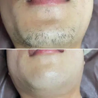 アイブロウ マツエク・マツパ メンズ キッズ Epina 千葉店 【エピナ】のエステ・リラクイメージ