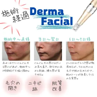 肌質改善サロン chouchouのエステ・リラクイメージ