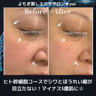 よもぎ蒸しサロン ゆんのエステ・リラクイメージ