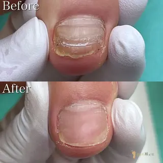 ネイル 大宮 巻き爪補正店のエステ・リラクイメージ