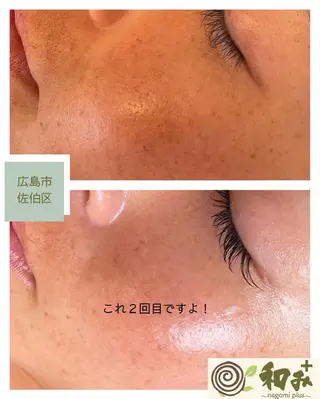 美肌とヘッド ナゴミプラスのエステ・リラクイメージ