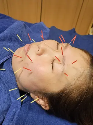 鍼灸整体院アレンジ所属・鍼灸整体院 アレンジのその他イメージ