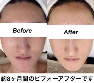 都度払い肌質改善 &脱毛Blancheのエステ・リラクイメージ