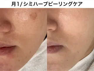 TRINIENCE 南流山店のエステ・リラクイメージ