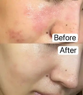 Belle原宿所属・佐藤 加奈のエステ・リラクイメージ