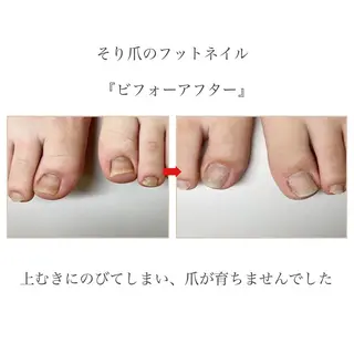 ネイル ネイルサロン アリュームのネイルデザイン
