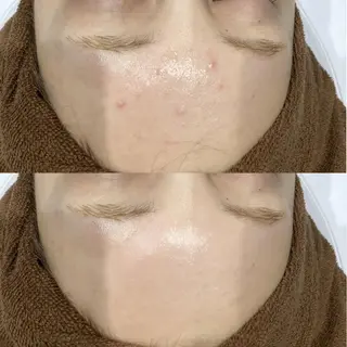 Dahlia痩身脱毛 フェイシャル 中村のエステ・リラクイメージ