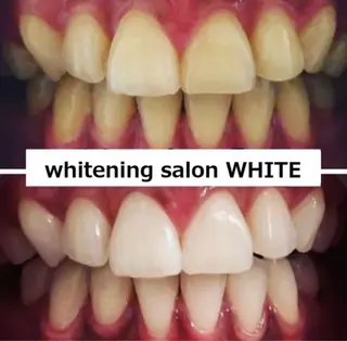 whitening salon WHITE 広島店所属・セルフホワイトニング 専門店WHITE広島のその他イメージ