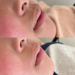 Rejue所属・永田 茜のエステ・リラクイメージ