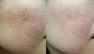 愛維美水光美肌専門店所属・愛維美水光美肌専門店 メンズレディースokのエステ・リラクイメージ