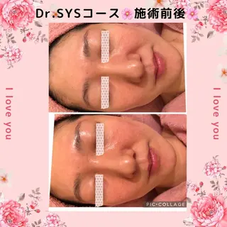 y.laBelle 艶肌・小顔・肌質改善のエステ・リラクイメージ